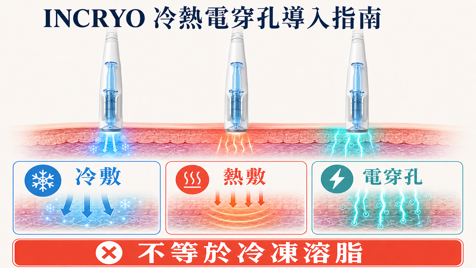 INCRYO冷熱電穿孔導入指南，展示冷敷、溫熱和電穿孔三種獨立功能