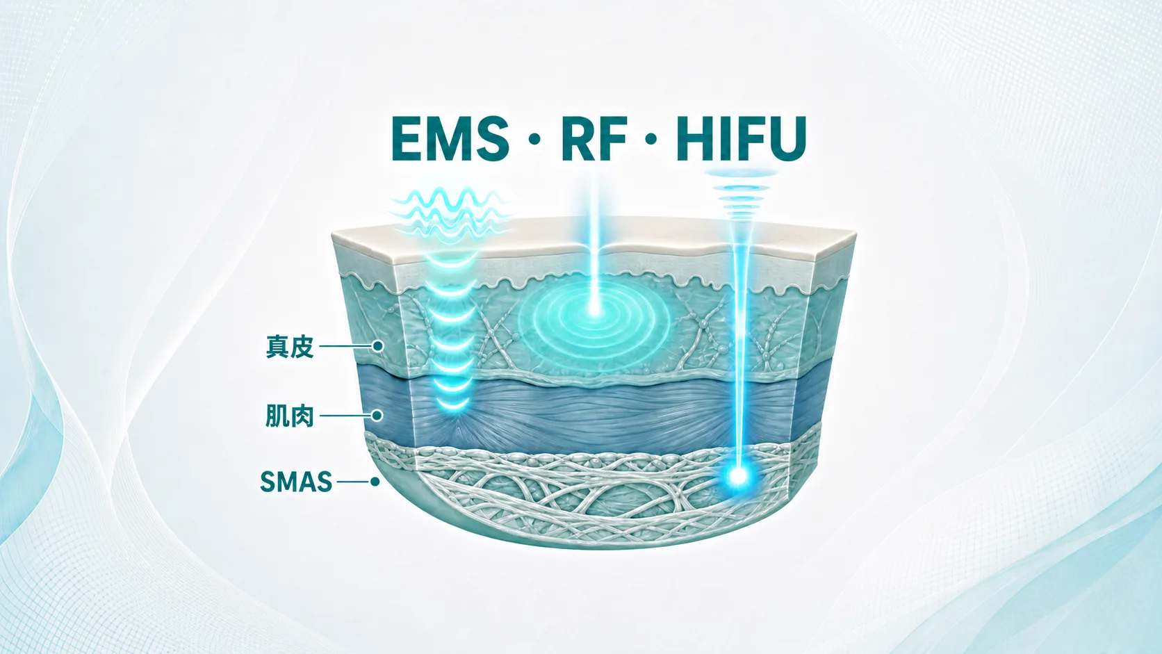 Comparison of facial EMS, RF, HIFU and microcurrent by tissue layer: muscle, dermis, SMAS and cellular level Comparison of facial EMS, RF, HIFU and microcurrent by tissue layer: muscle, dermis, SMAS and cellular level