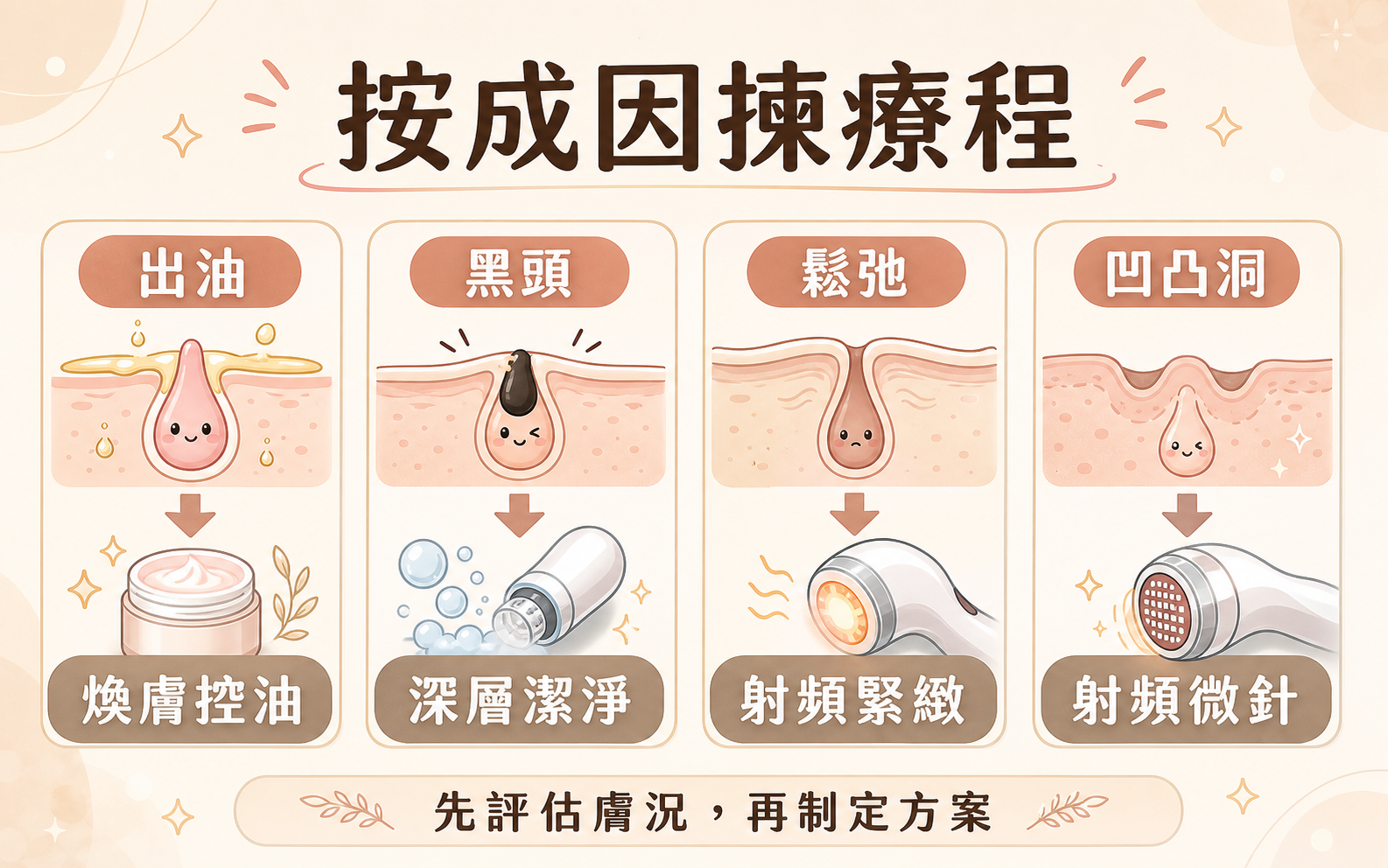 按成因揀收毛孔療程 IG 風格插畫
