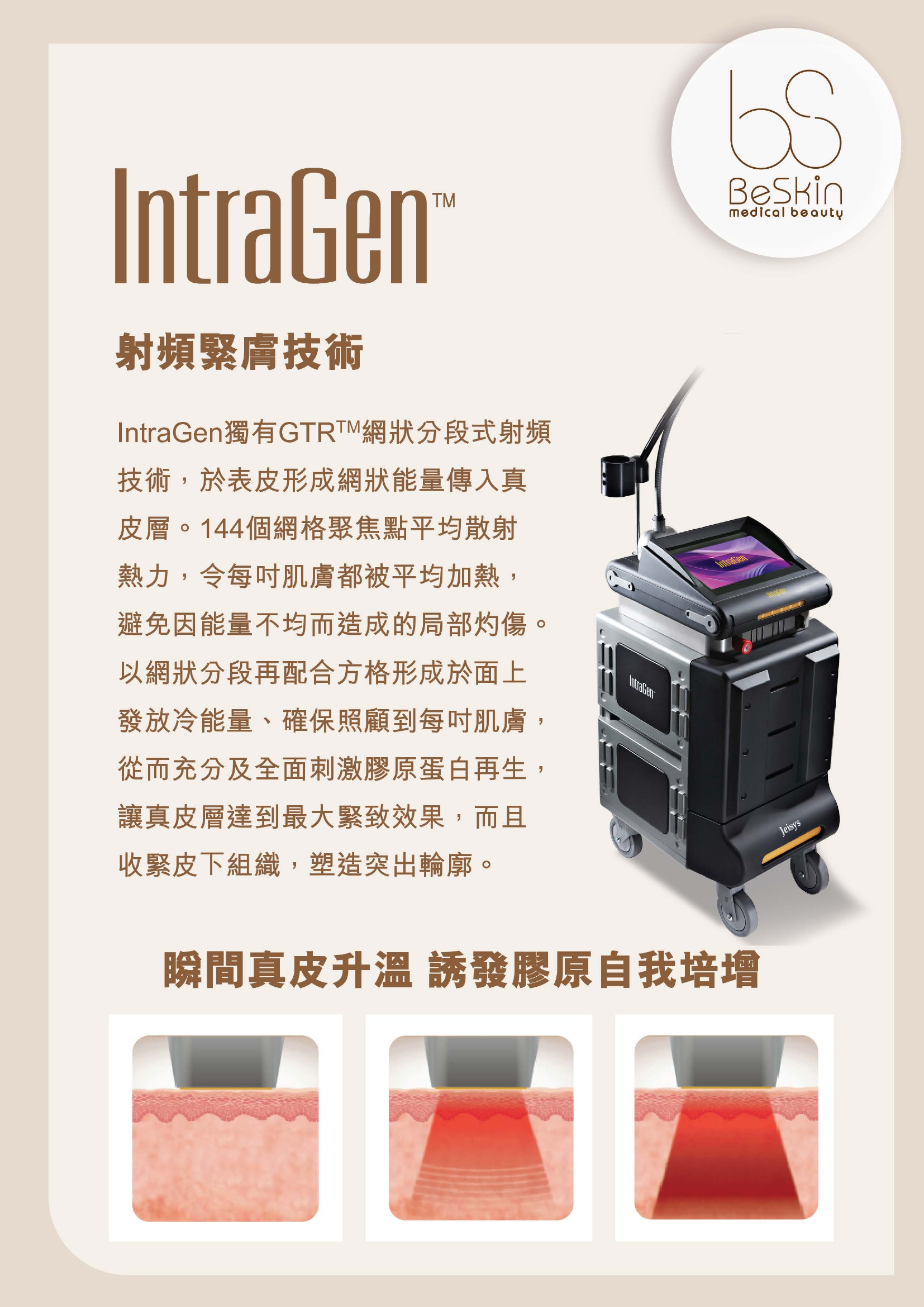 IntraGen 射頻緊緻可用於眼周鬆弛及膠原管理評估