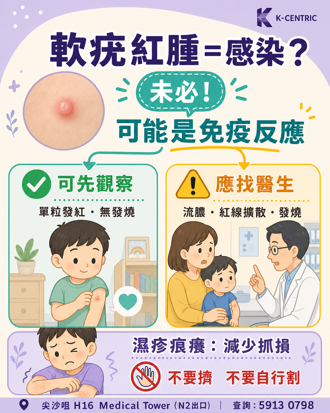 軟疣紅腫不一定等於感染 傳染性軟疣紅腫家長判斷圖,分辨可能的免疫反應與需要求醫的感染警號