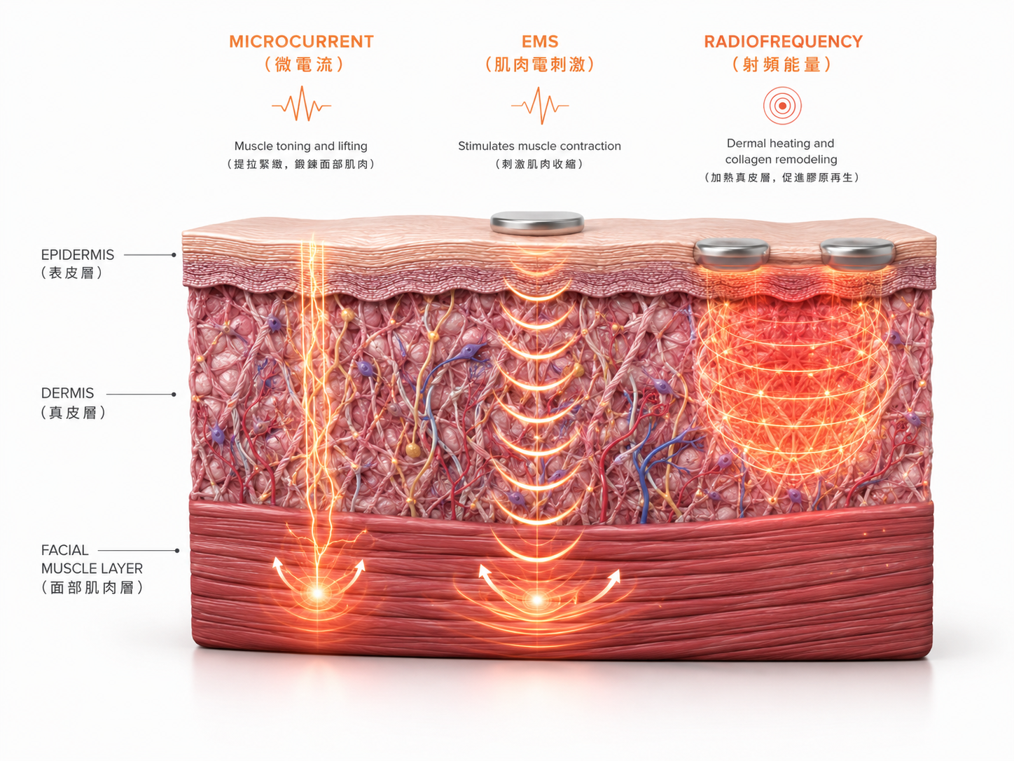 microcurrent ems radiofrequency