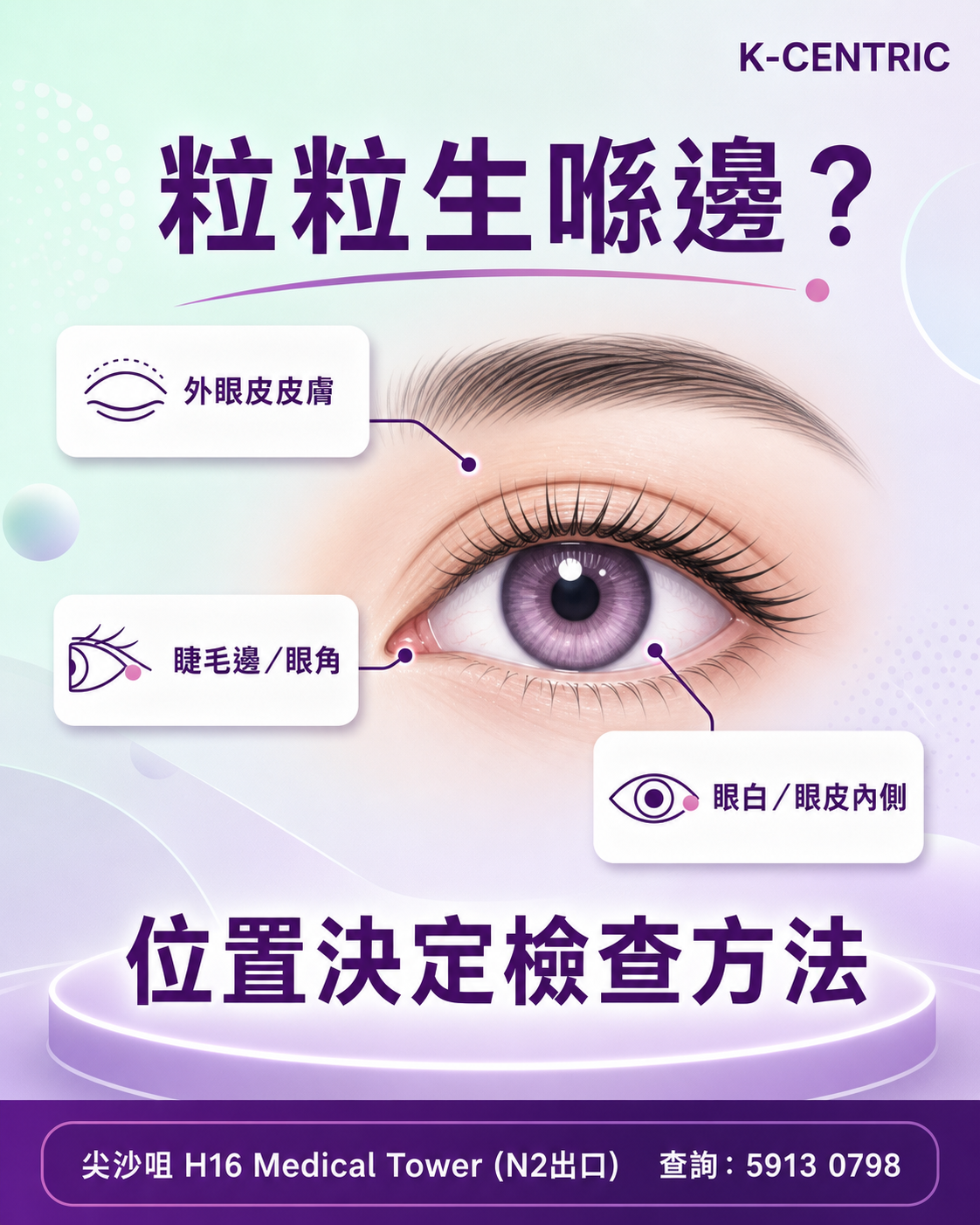 眼皮粒粒位置與求醫分流圖 外眼皮皮膚睫毛邊眼角與眼白眼皮內側的求醫位置分流圖