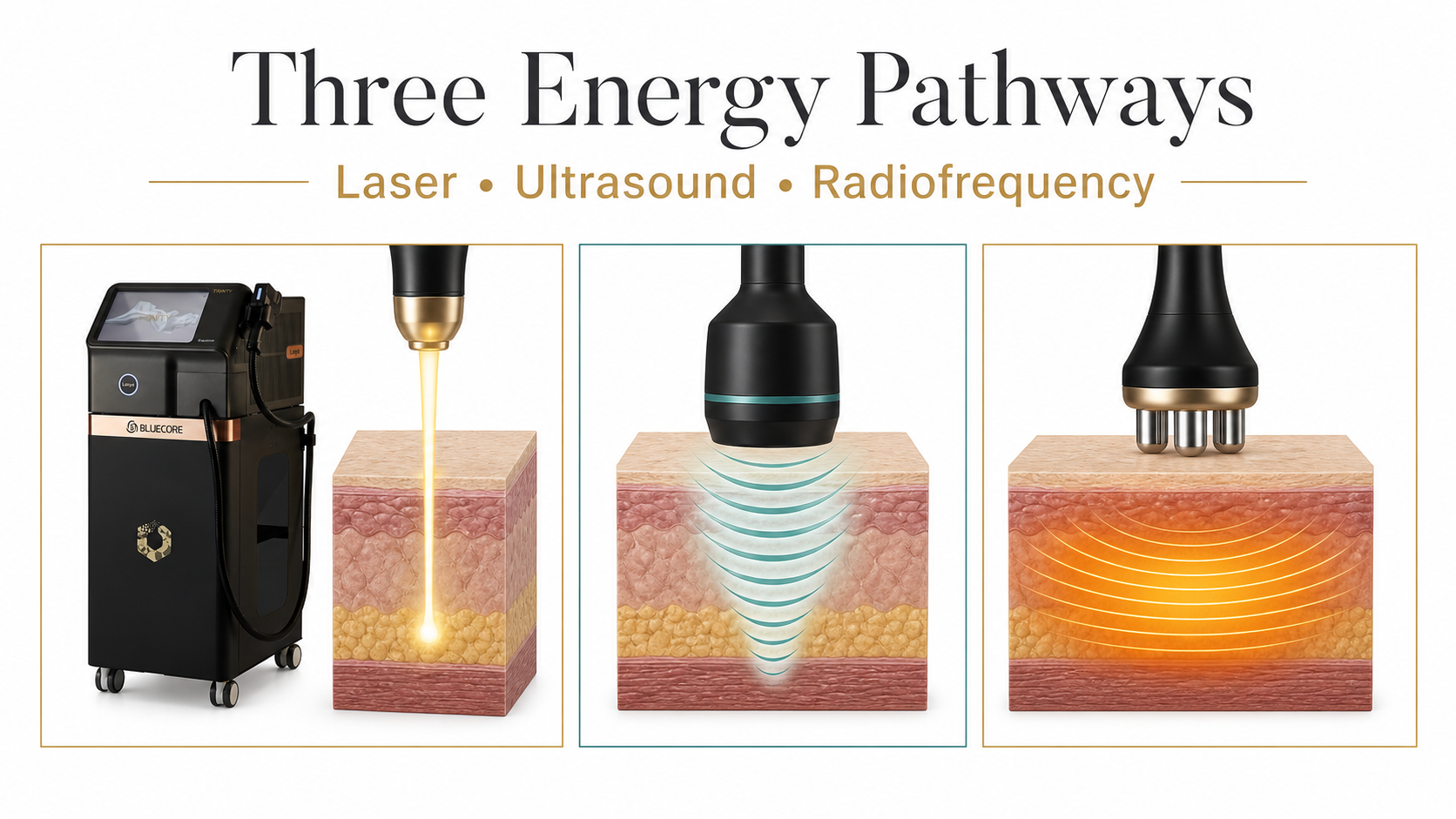 Three energy pathways: laser, ultrasound and radiofrequency Three energy pathways: laser, ultrasound and radiofrequency