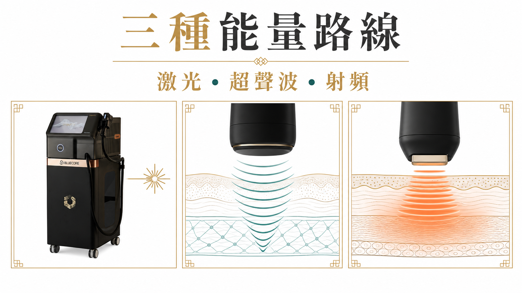激光、超聲波及射頻三種能量路線 激光、超聲波及射頻三種能量路線