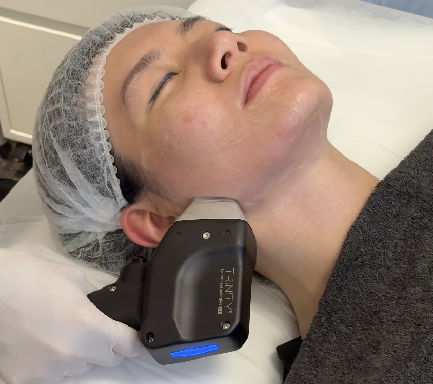 trinity liftoning facial treatment in progress trinity liftoning facial treatment in progress