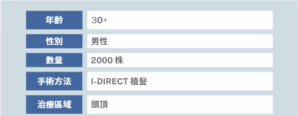 I-LAND頭頂2000株植髮案例術後
