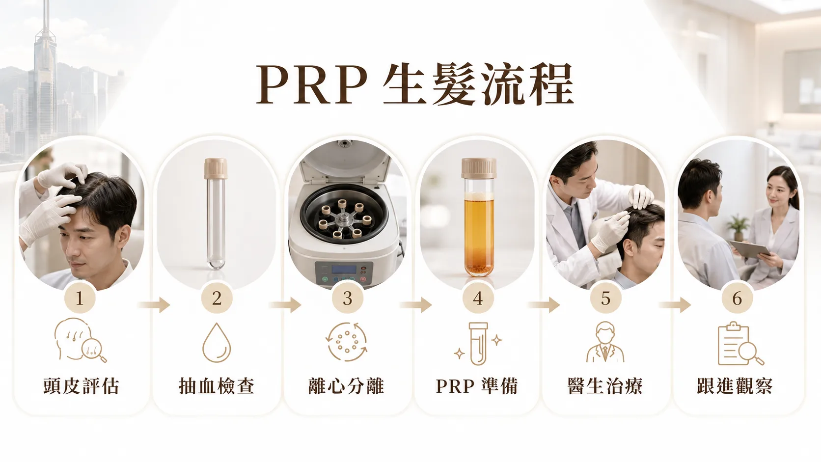 PRP 生髮流程圖 I-LAND TOWER 頭皮治療示意