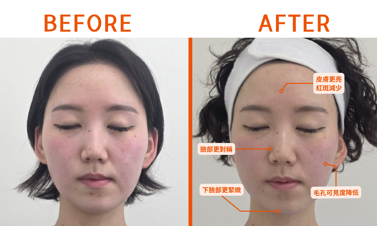 Before After Eve Titan