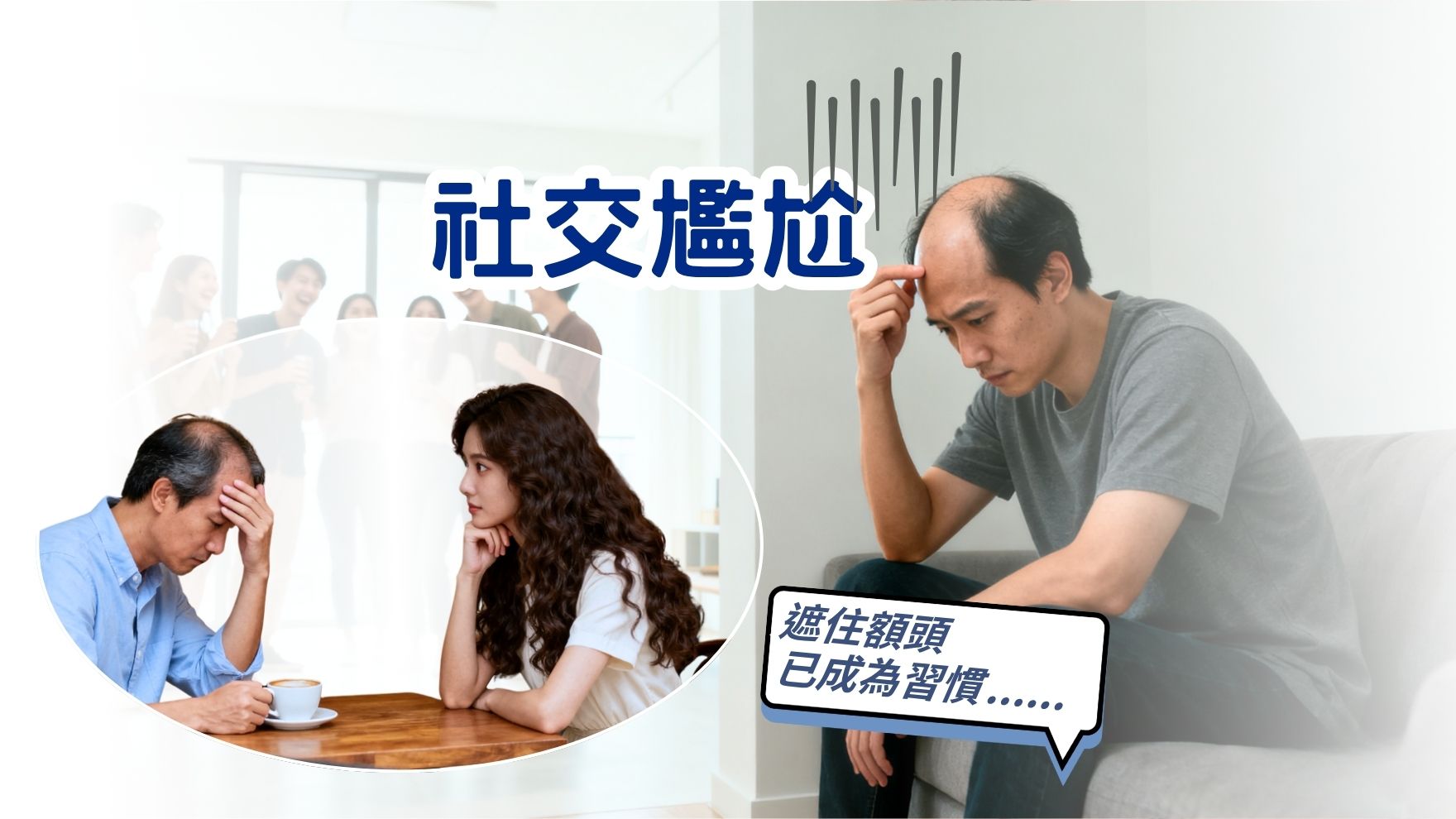 髮量危機——植髮全攻略