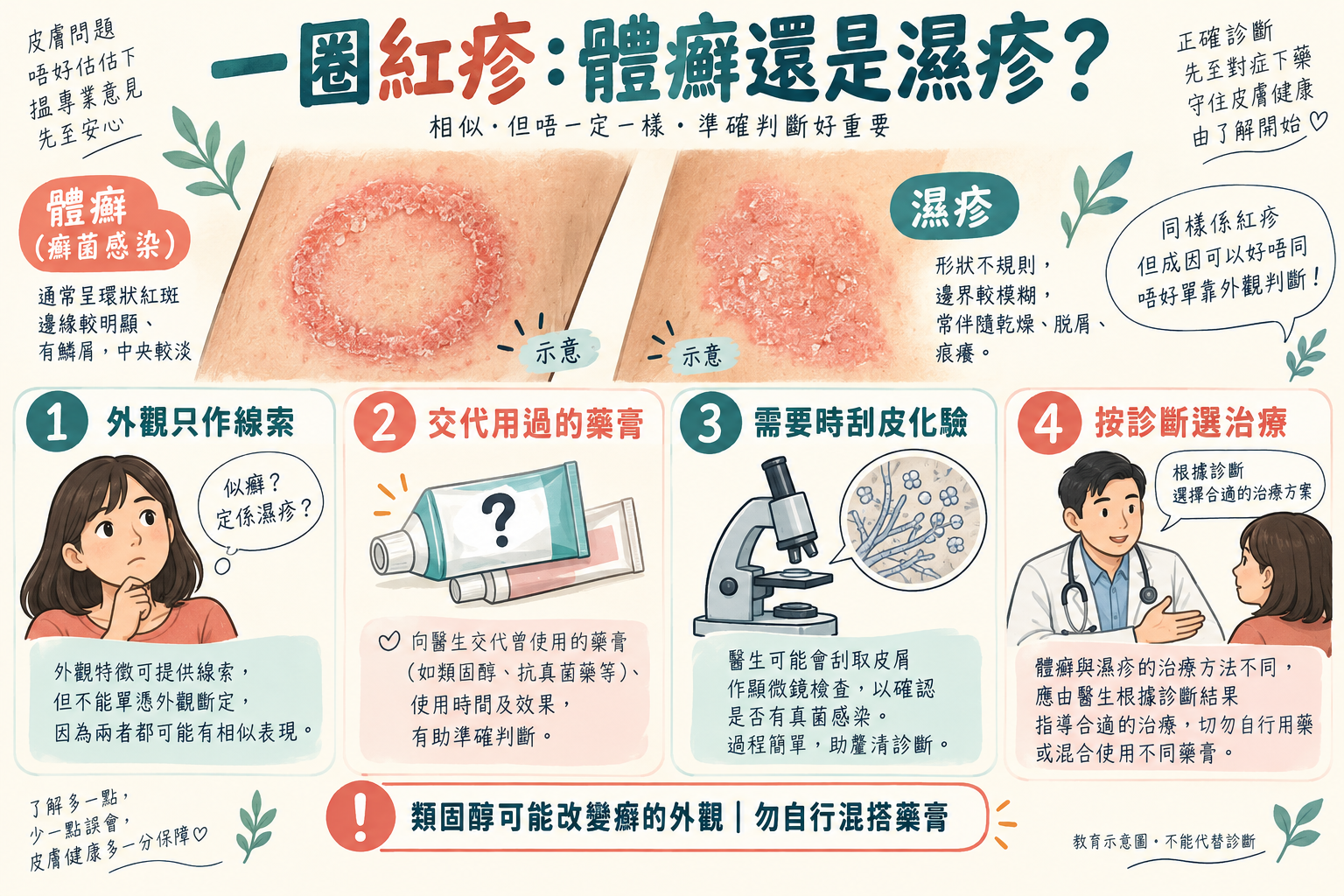 體癬、濕疹與類固醇令真菌皮疹變樣的示意 體癬、濕疹與類固醇令真菌皮疹變樣的示意