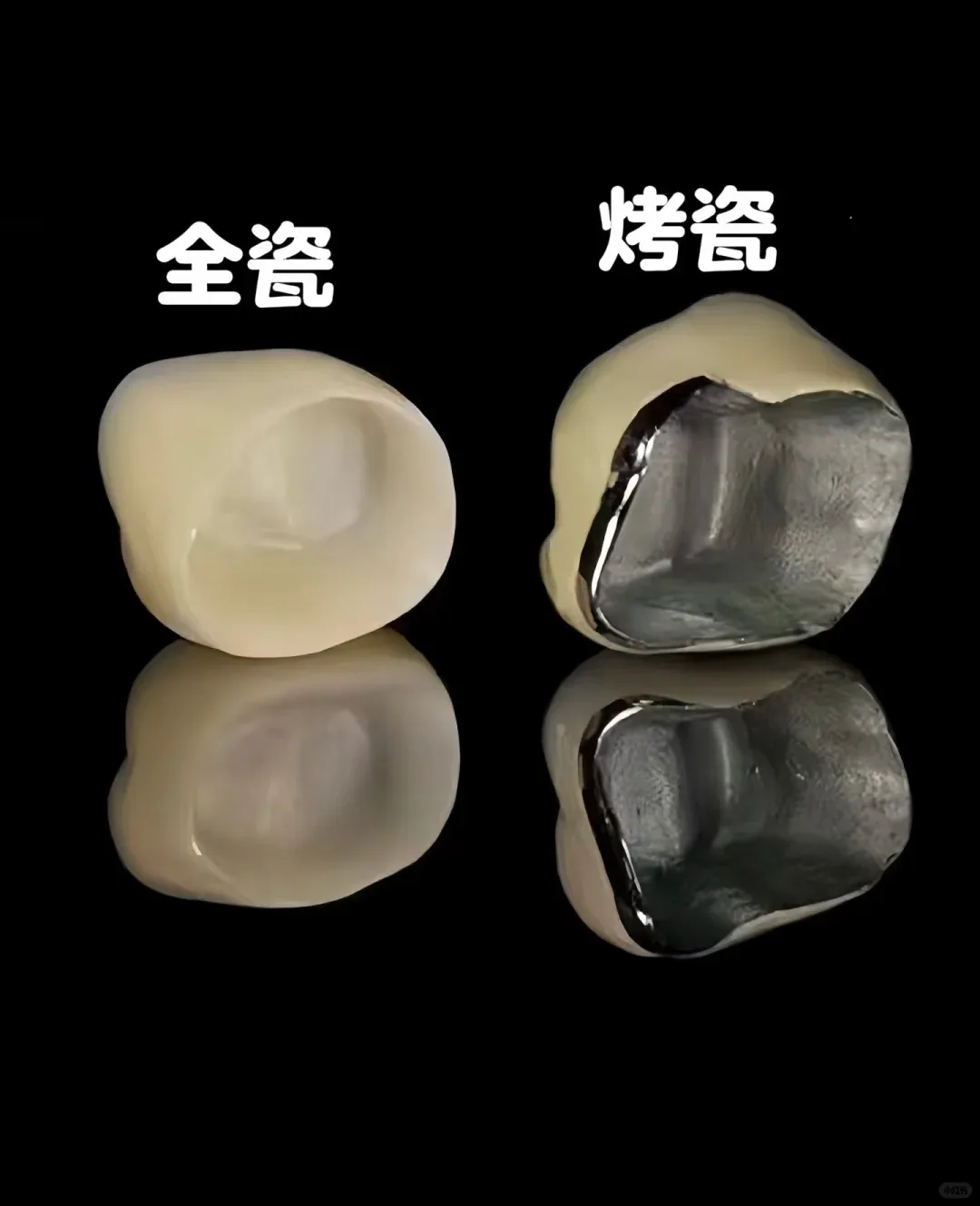 全瓷牙貼片:讓您的笑容重現自然光采!了解全瓷牙與烤瓷牙的差異,聰明選擇最佳美學修復方案