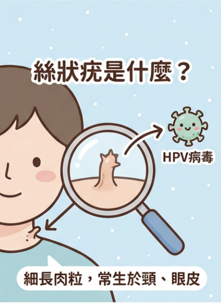 絲狀疣是什麼