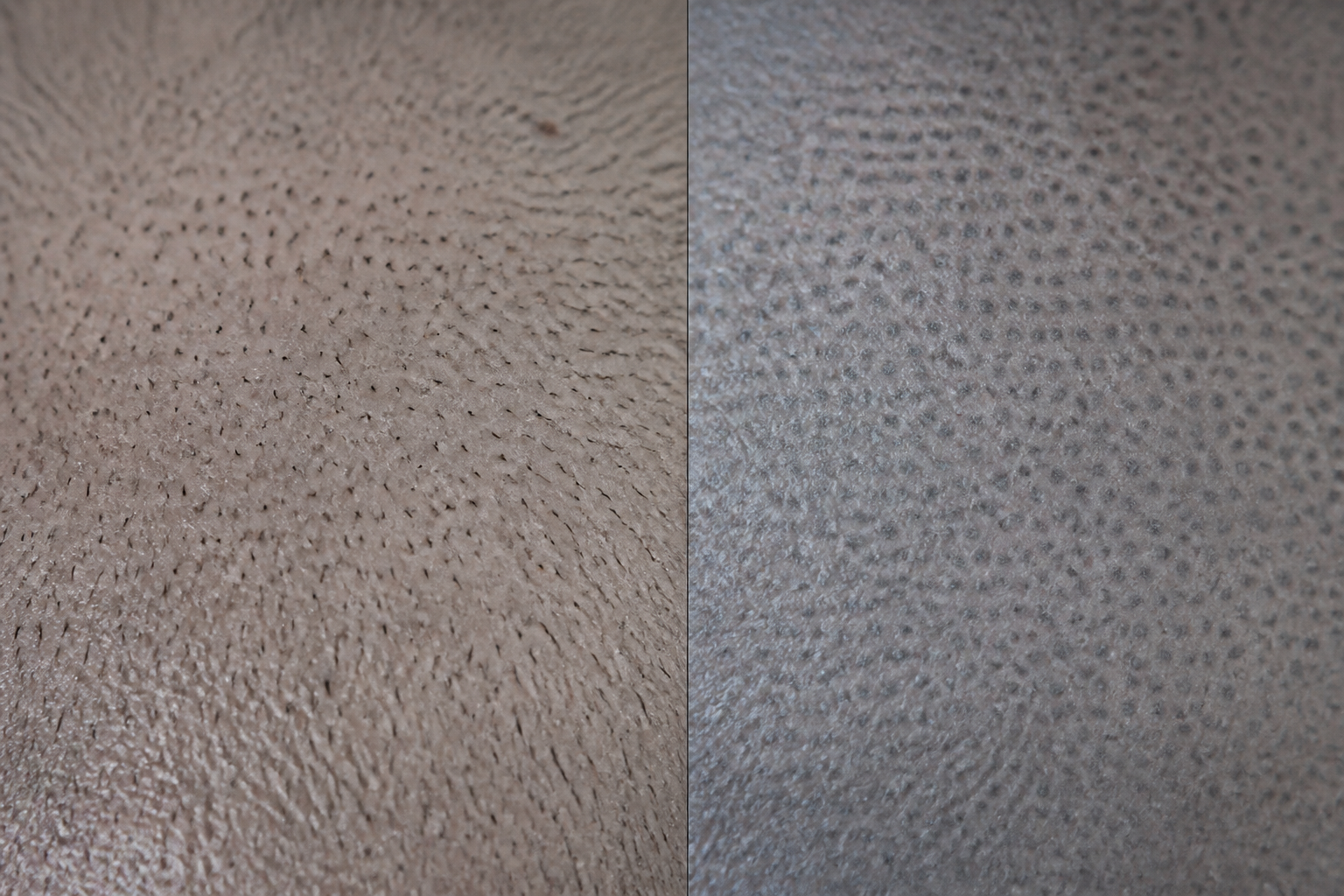 Close comparison of crisp neutral SMP dots and overly dense blurred cool-toned pigment on realistic scalp skin